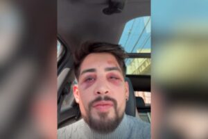 Empresário denuncia agressão por funcionários de karaokê em São Paulo