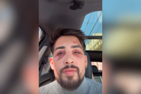 Empresário denuncia agressão por funcionários de karaokê em São Paulo