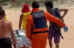 Mulher sofre ataque de capivara durante mergulho e fica sem parte da nádega